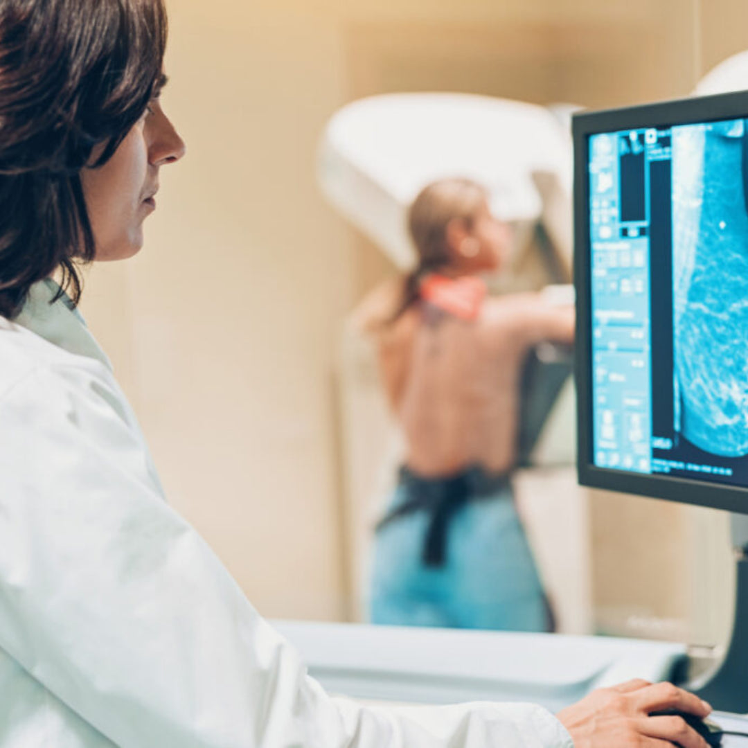 Understanding Dense Breasts: Advocating for Your Health
